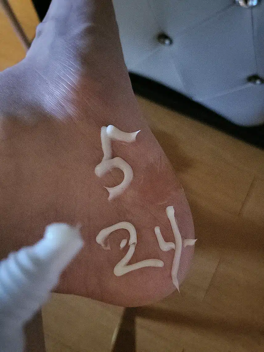발케어