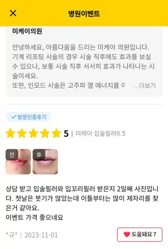 서초구 미케이의원 입술필러 후기추천해요~!