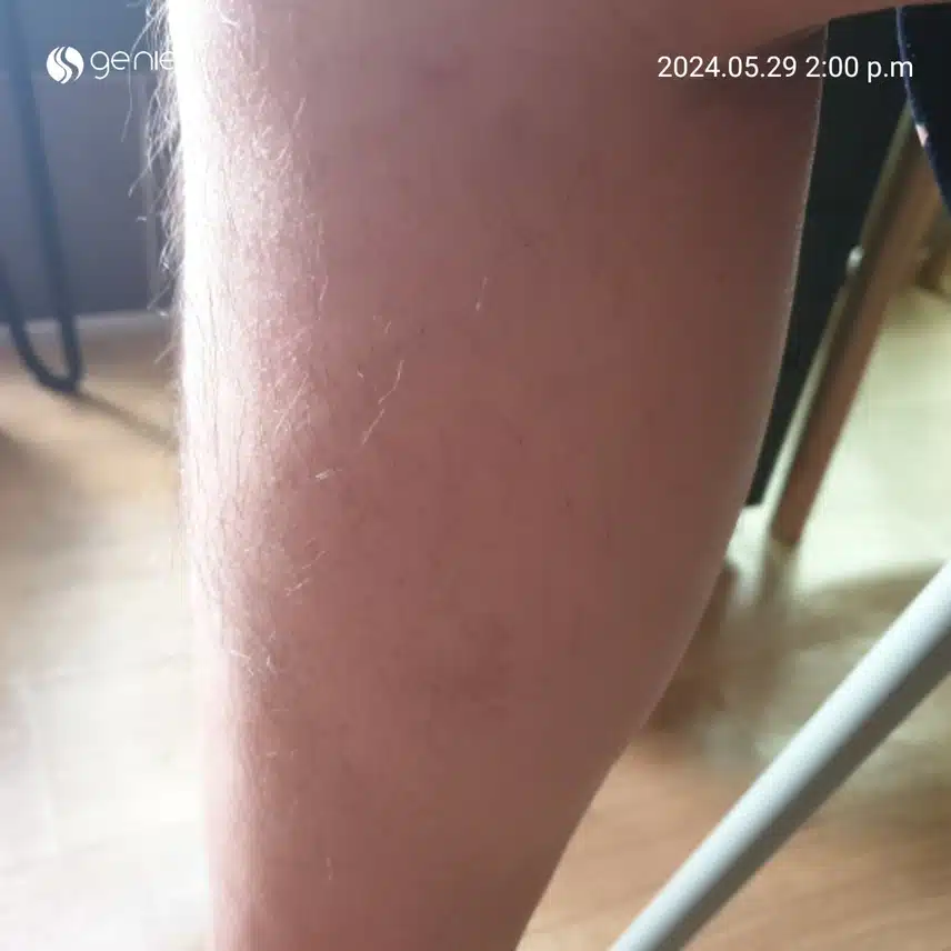 혈당스파이크 예방 운동 방법