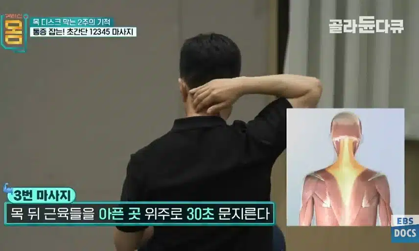 다이소 폼롤러로 두통과 목뻣뻣함 해결! (장수왕 나만의 두통대처법)