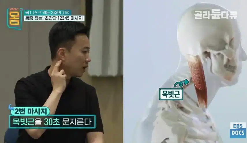 다이소 폼롤러로 두통과 목뻣뻣함 해결! (장수왕 나만의 두통대처법)