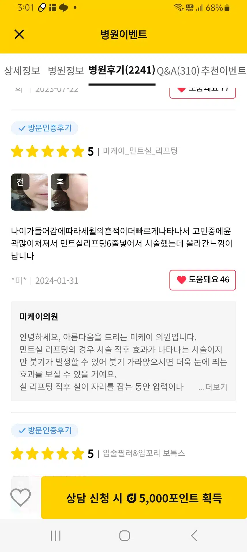 서초구 미케이 의원 인모드 리프팅 후기 추천해요!