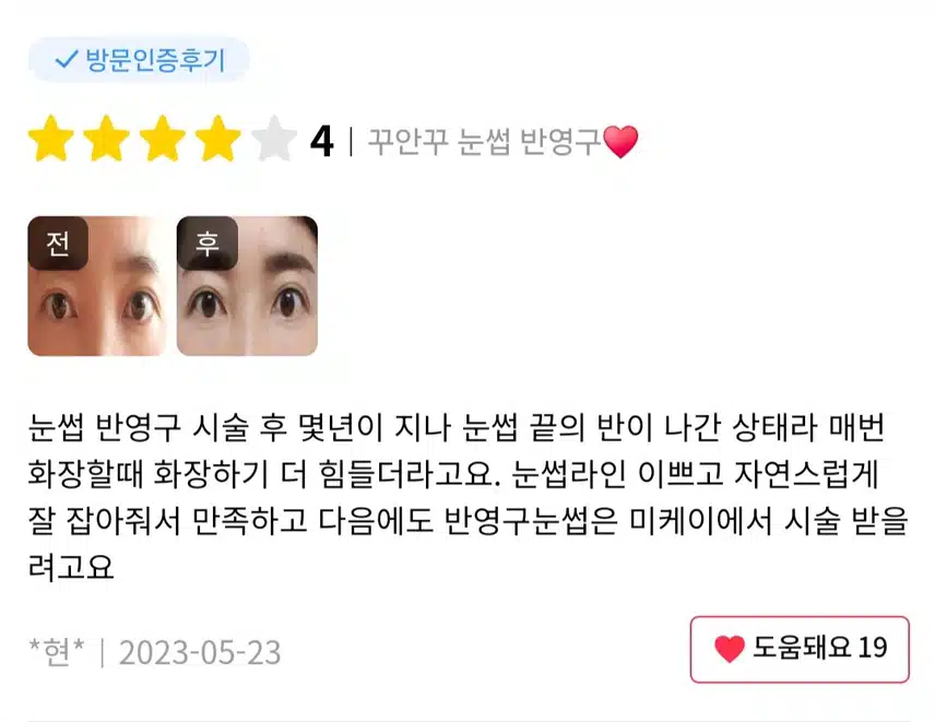 추천왕) 서초구 미케이의원 _ 눈썹 반영구 추천합니다