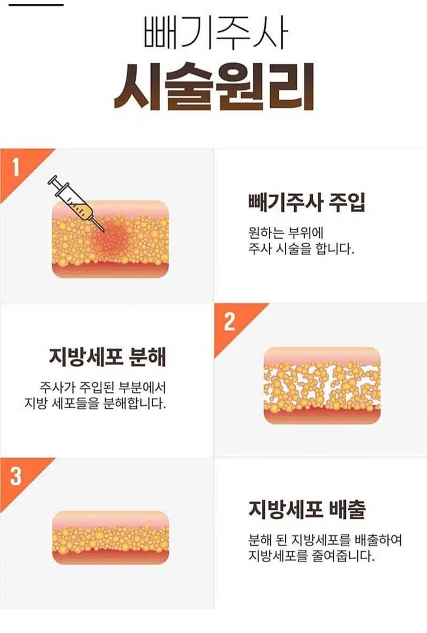 미케이의원 빼기 주사 이벤트 추천합니다