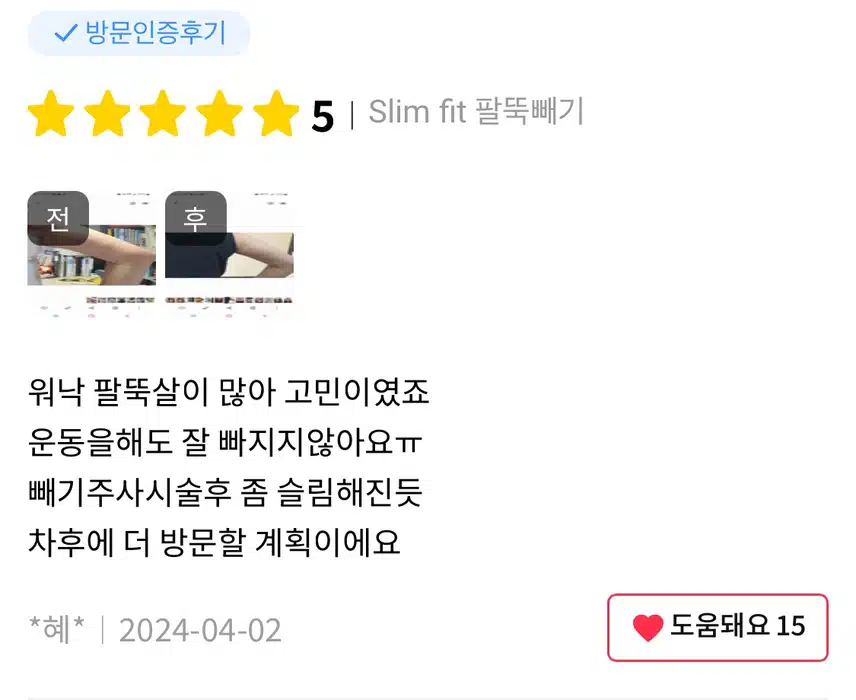 미케이의원 빼기 주사 이벤트 추천합니다