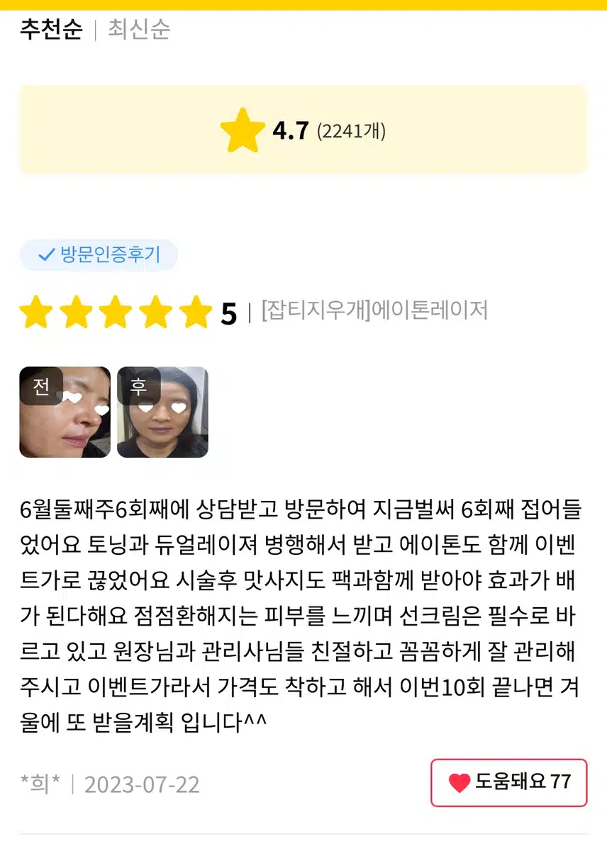 미케이의원 빼기 주사 이벤트 추천합니다