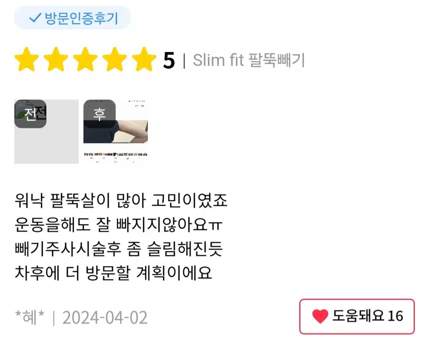 미케이의원 팔뚝살빼기 소개합니다 