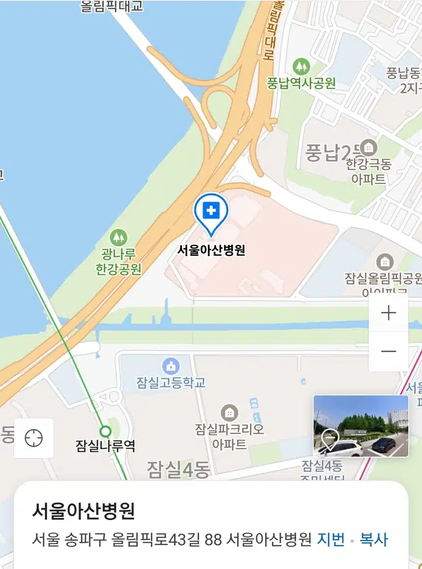 아산병원 안과 진료 후기입니다