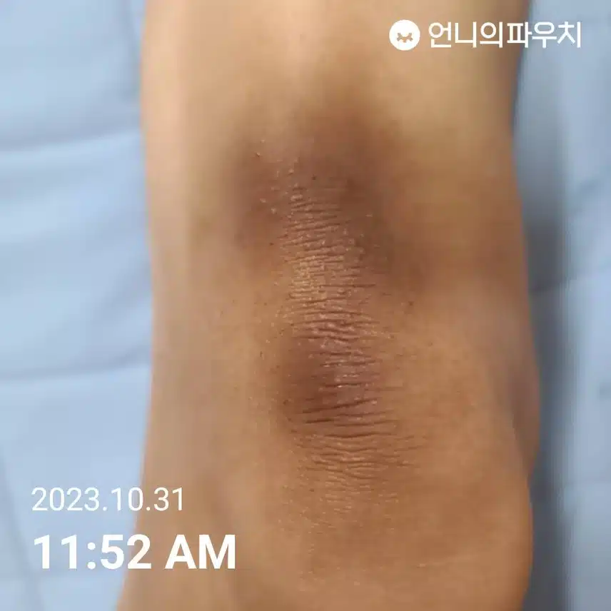 실패한 내돈내산  리얼화이트닝 이펙트 프리미엄 