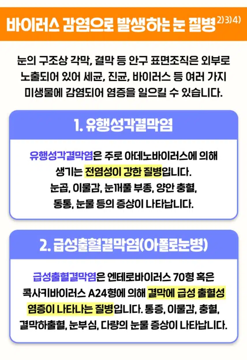 여름철 눈건강 관리법