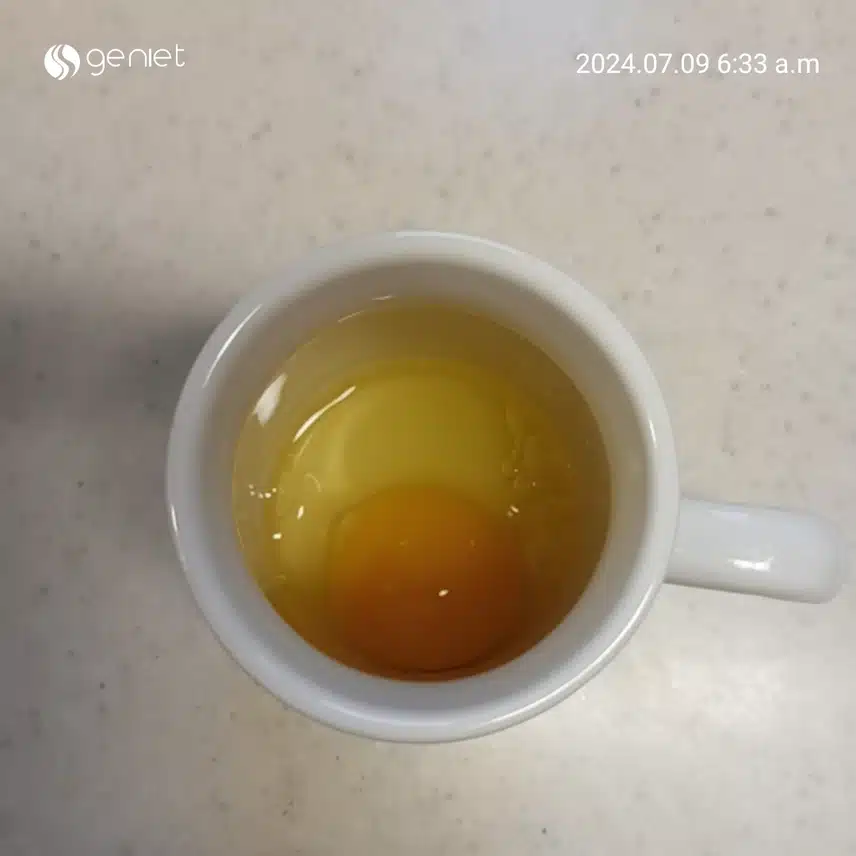 들기름을 아침마다 먹는 이유