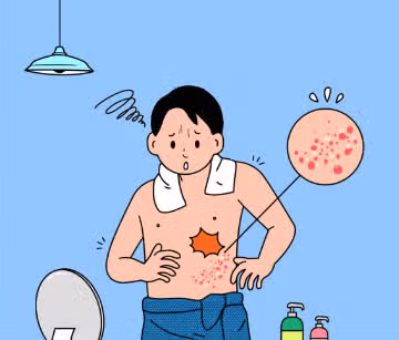 대상포진 전염되나요? 전염력 궁금해요