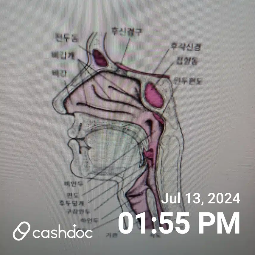 비염  치료약  투리온정과  소금물 로 씻어내가