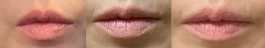 환자중심으로 진료하는 연세예피부과 소개해요~