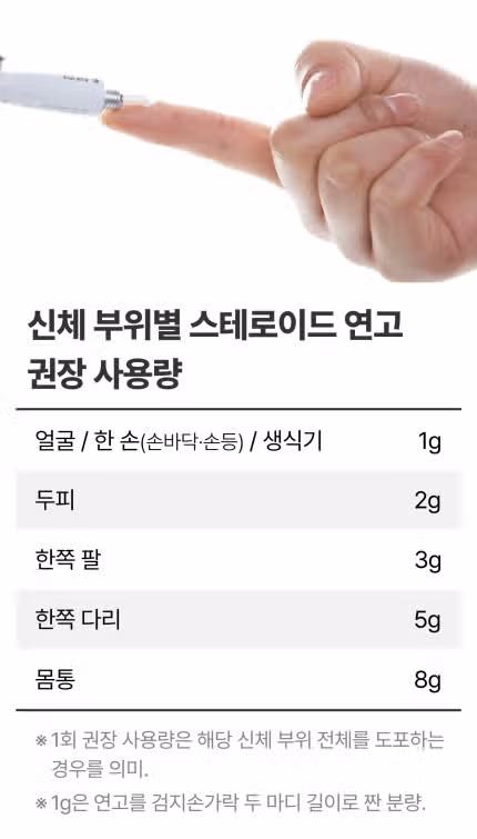 스테로이드 연고, 얼마만큼 짜야 할까? 손가락 두 마디 양으로 '이곳' 전체 커버