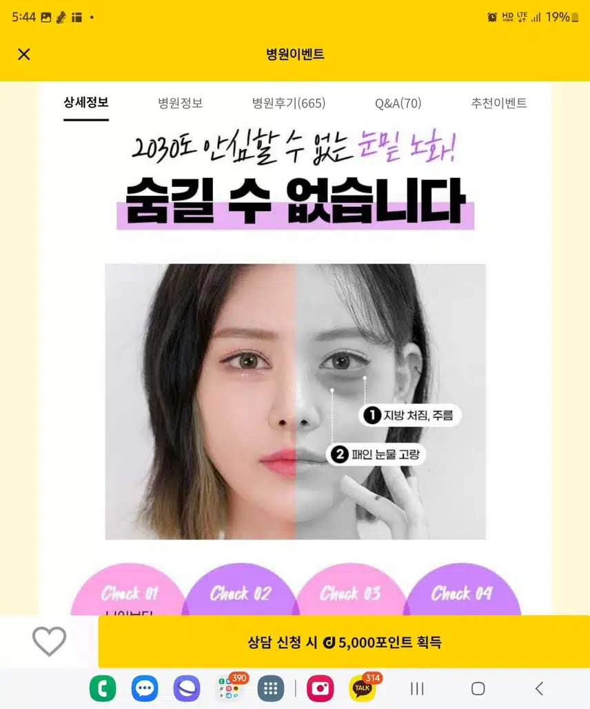 강남구에이탑성형외과 지방재배치 후기 추천..