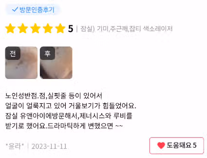 유앤아이의원 잠실점 색소치료(기미,주근깨,잡티) 후기 추천합니다...^^