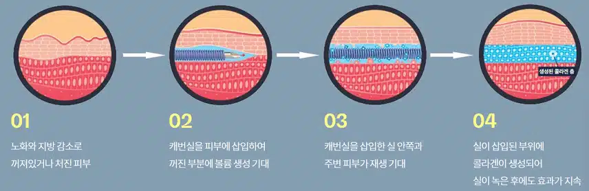(추천)이중턱 뿌시고 싶어요  ...클럽 미즈라미체의원