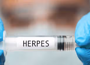 ¿Debería renunciar al matrimonio si contraigo herpes tipo 1?