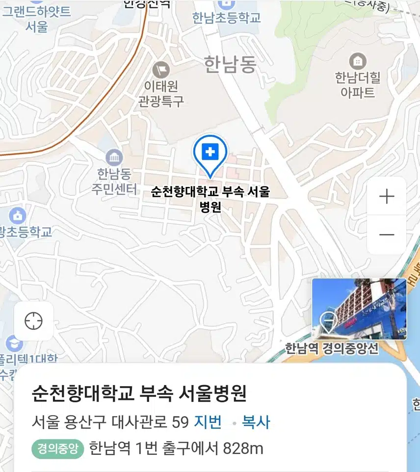 순천향대병원 대장게실염 (아랫배 통증) 치료 후기