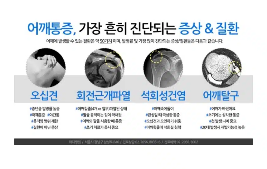 오른쪽 팔을 뒤쪽으로 움직이면 아파요