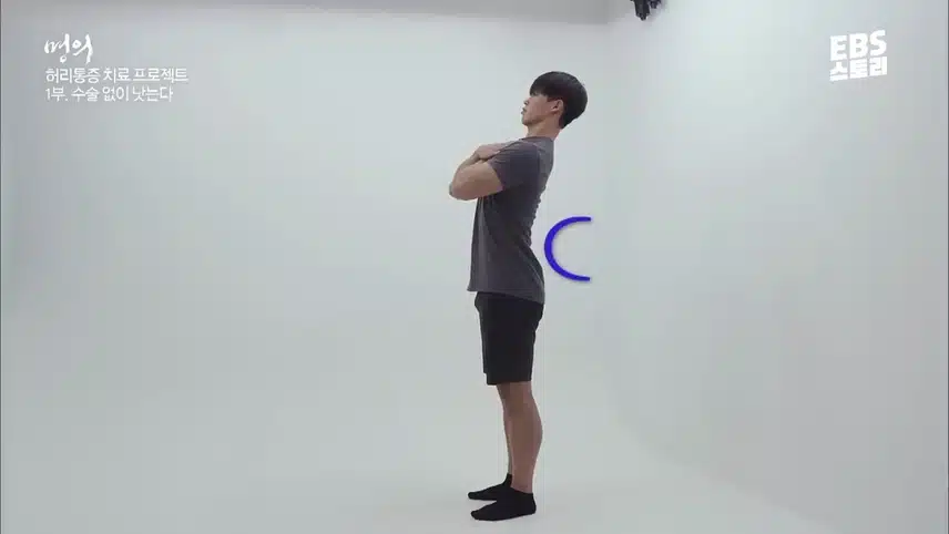 허리디스크 통증은 요추전만 자세로 해결