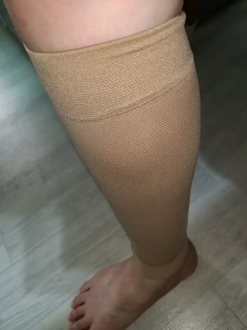 종아리 통증으로 여름나기 너무 힘드네요ㅠ