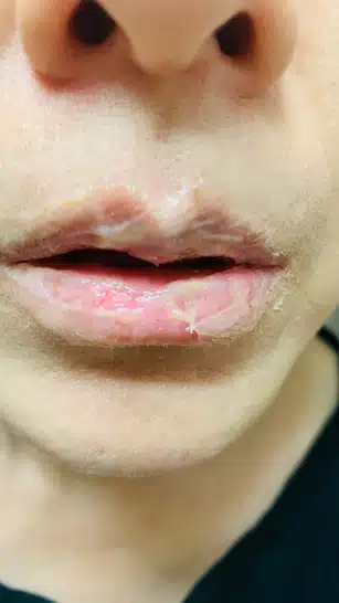 쿨민건녀-  립스크럽과 보습크림을 한번에 