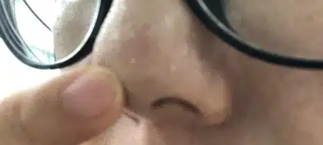 모공 때문에 자주 생기는 화이트헤드는 어떻게 관리하시나요??