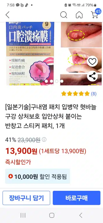 구내염 빨리 낫는법 - 구내염 알보칠과 구내염 패치