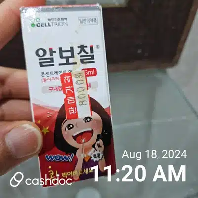 구내염 빨리 낫는법 - 구내염 알보칠과 구내염 패치
