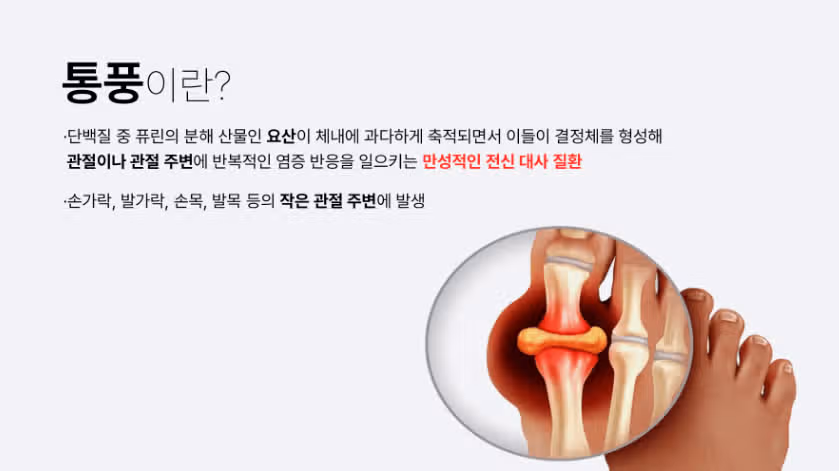 유청단백질 통풍 있다면 조심하세요!