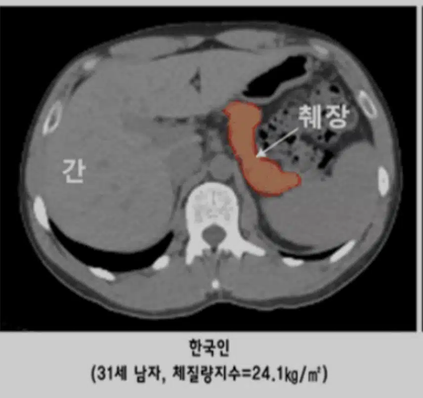 생각보다 작고 소중한 한국인 그것jpg