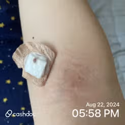 기절 원인 - 너무 더워서 기절한 썰