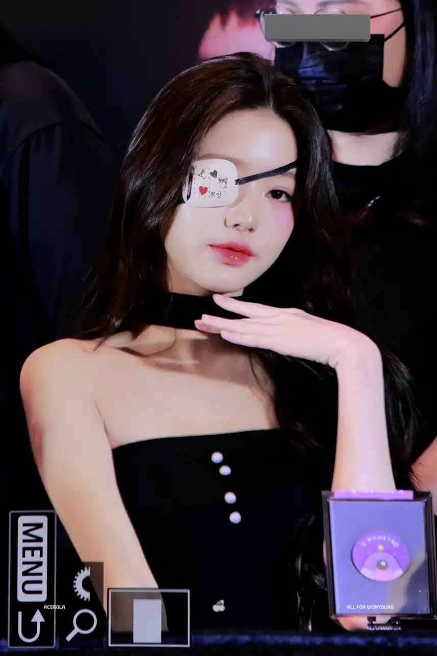 다쳐서 안대끼고 나온 워녕 ㅠ 