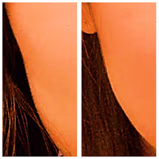 써마지 울쎄라 차이 궁금했다면? 전후사진 공유해요