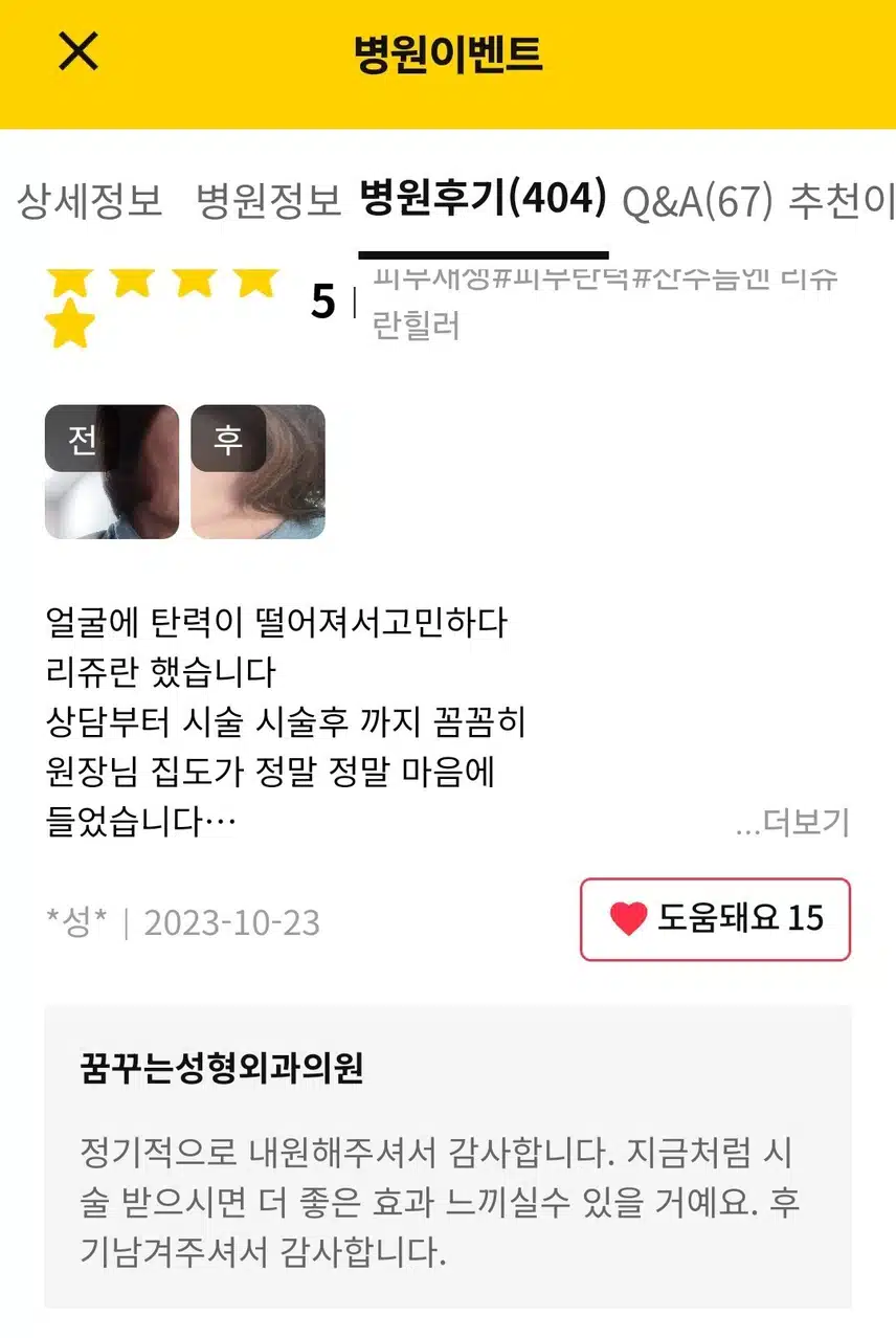 꿈꾸는 성형외과 리쥬란힐러 피부재생 병원후기 굿