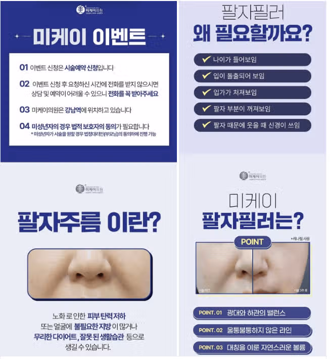 미케이의원 팔자필러 3.8만원 이벤트! 후기도 가격도 좋네요.