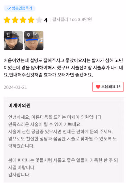 미케이의원 팔자필러 3.8만원 이벤트! 후기도 가격도 좋네요.