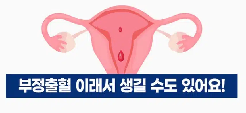 부정출혈 완치까지 2년, 치료시 주의점 3가지 알려드려요. 