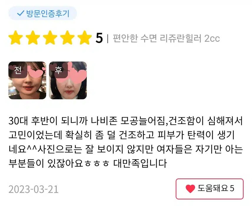컴포트성형외과 편안한 수면 리쥬란 힐러 2cc 후기 추천해요!!