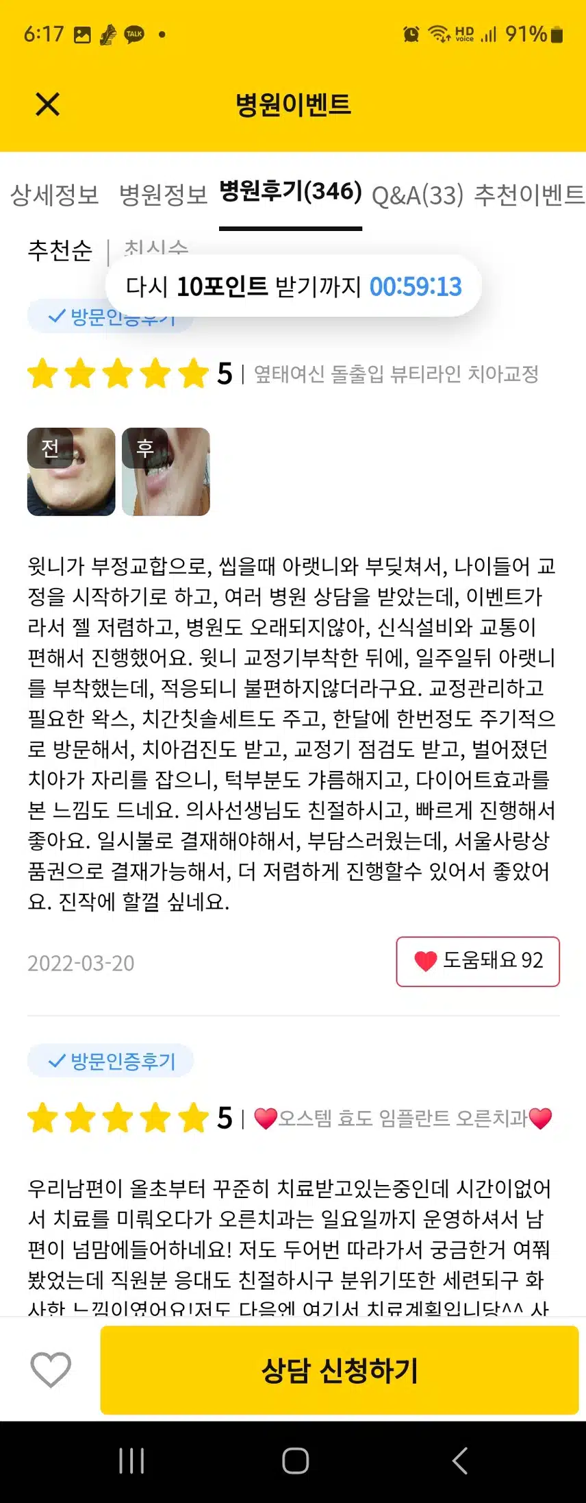 치아 지르코니아관련 노원구 오른치과의원 후기추천