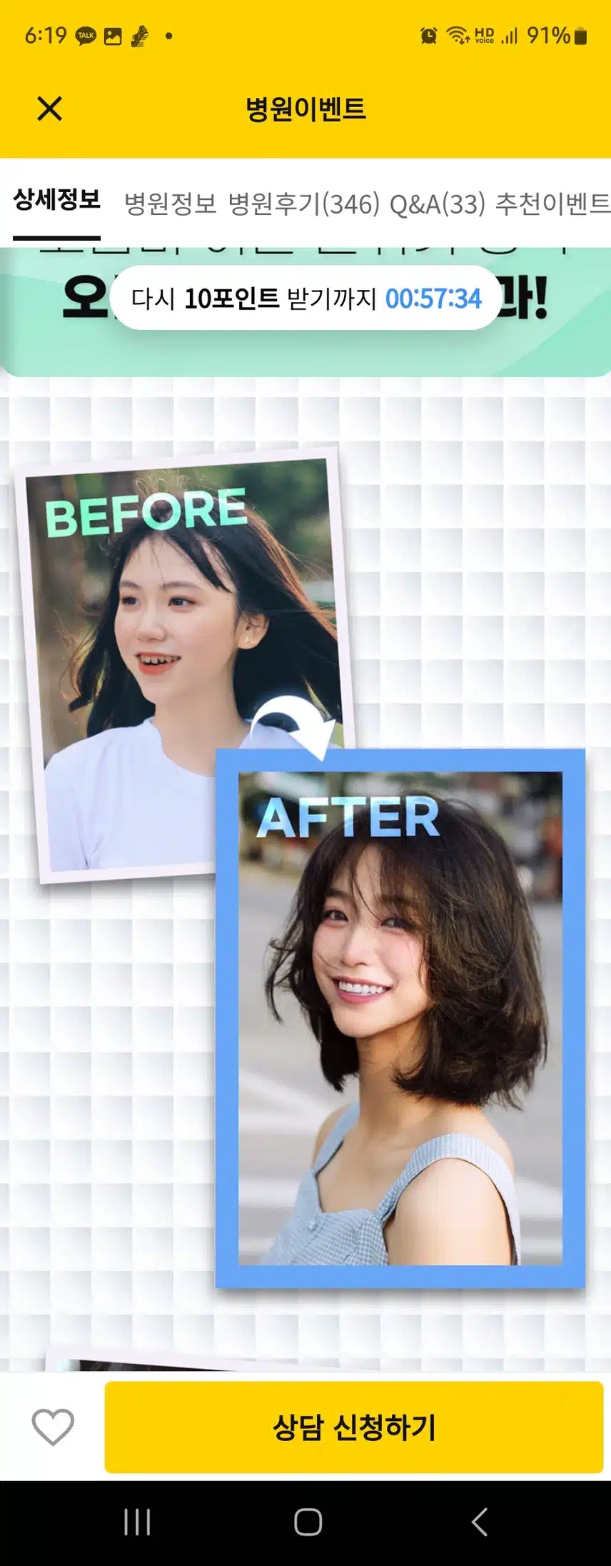 치아 지르코니아관련 노원구 오른치과의원 후기추천