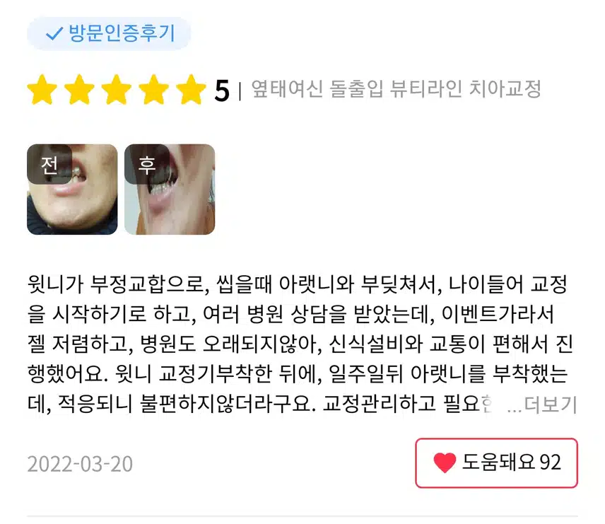 오른치과의원 뷰티라인 치아교정 후기를 추천하고 리뷰하고자 합니다! 