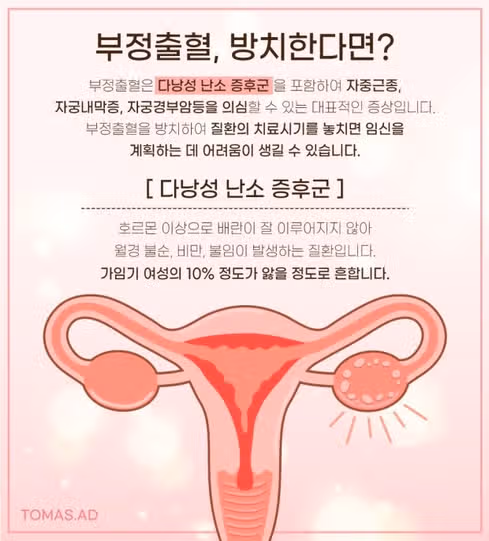 식욕억제제 부작용으로 한달에 부정출혈 3번 겪은 경험 공유합니다