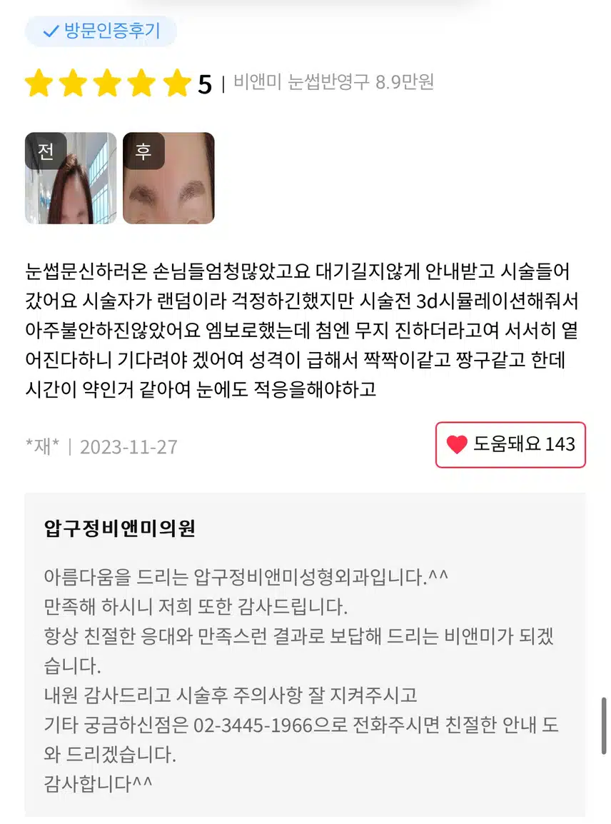 [추천] 압구정비앤미의원 눈썹 반영구 이벤트와 후기 좋아요!