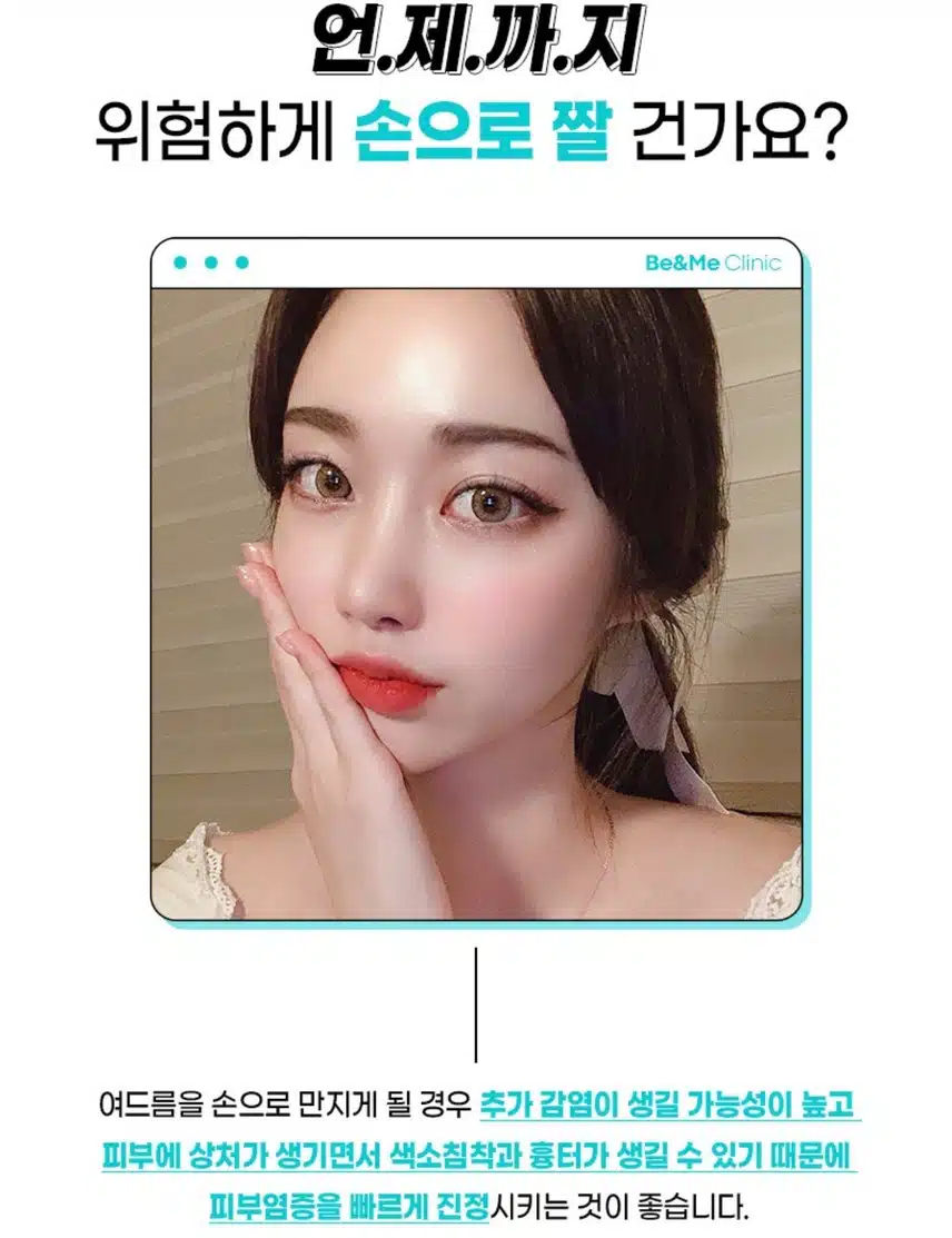 압구정비앤미 여드름염증주사 후기와 이벤트 추천합니다