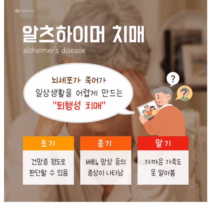 저희 시아버님이 치매를 앓고 계세요.