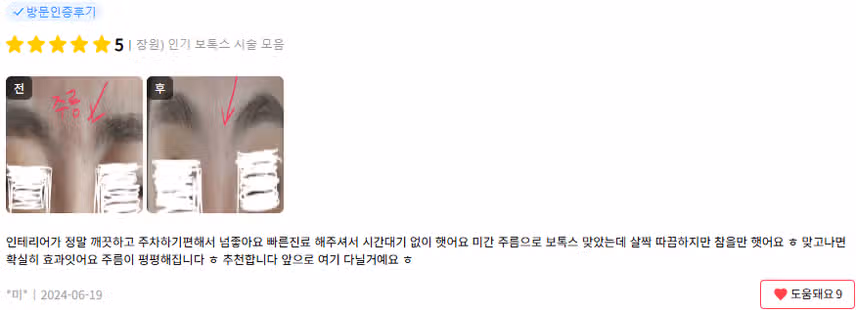 유앤아이의원 창원점 주름보톡스 시술 후기 도움돼요~