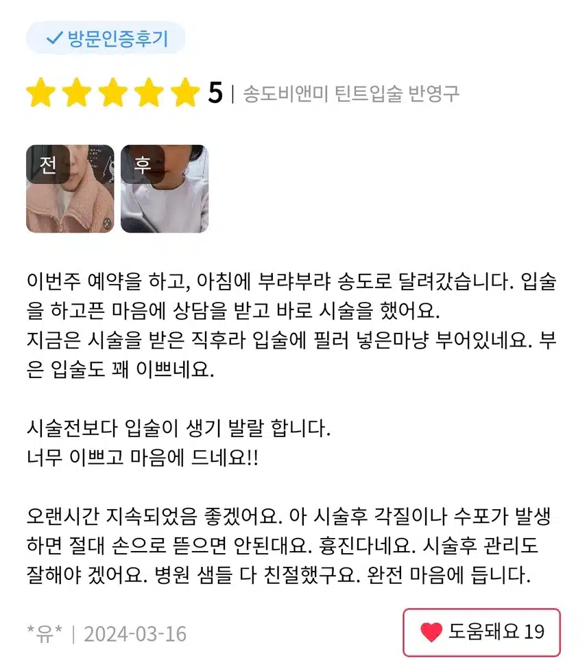 송도비앤미 의원 입술 반영구 후기 추천합니다.